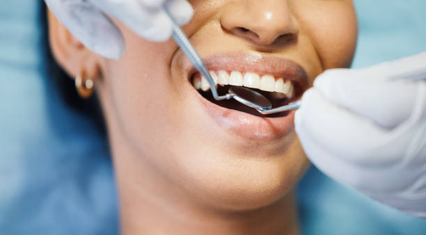 Best Emergency Dental Filling Replacement  in Bartlett, TX